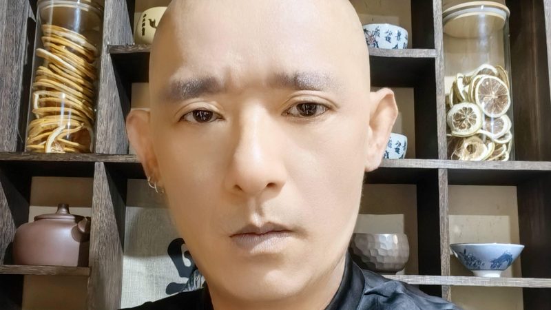 针灸与康复理疗：异曲同工之妙，各有侧重